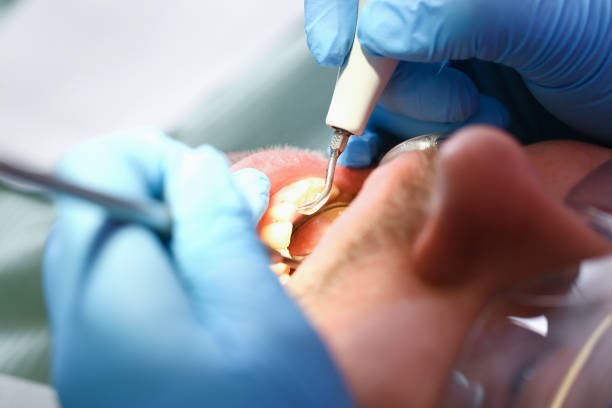 Best Urgent Care for Lost Fillings or Crowns in Denver, PA